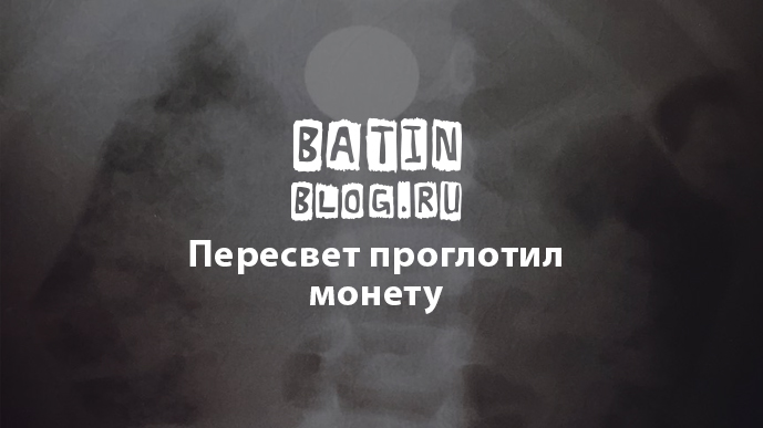 Проглотил монету 1 рубль что делать. Ребёнок проглотил монету 1 рубль. Что делать если проглотил монету. Что делать если ребёнок проглотил монету 1 рубль. Что будет если проглотить монету 2 рубля.